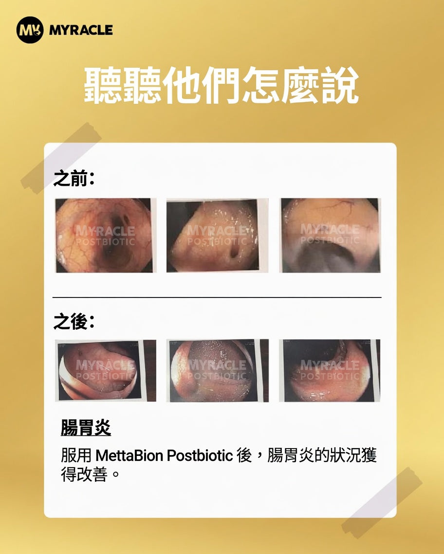 Postbiotic Liquid 黑金後生元液 5ml x 20條