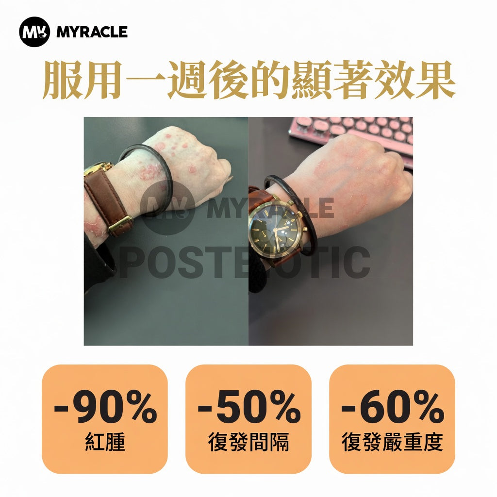 Postbiotic Liquid 黑金後生元液 5ml x 20條
