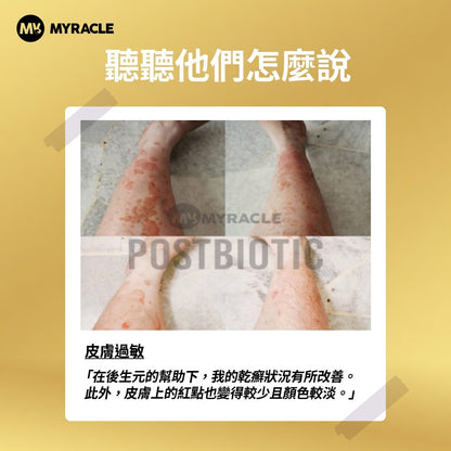 Postbiotic Liquid 黑金後生元液 5ml x 20條