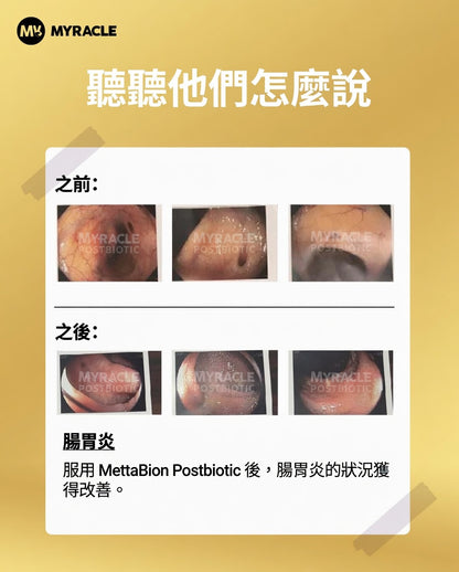 Postbiotic Liquid 黑金後生元液 5ml x 20條
